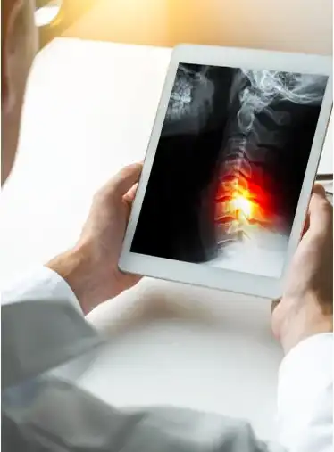 spinal cord injury